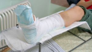 Injuries Commonly Seen in a Central Valley Hit-and-Run Bicycle Crash